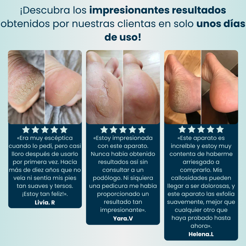 Lijadora anti-callos