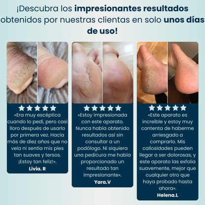 Lijadora anti-callos