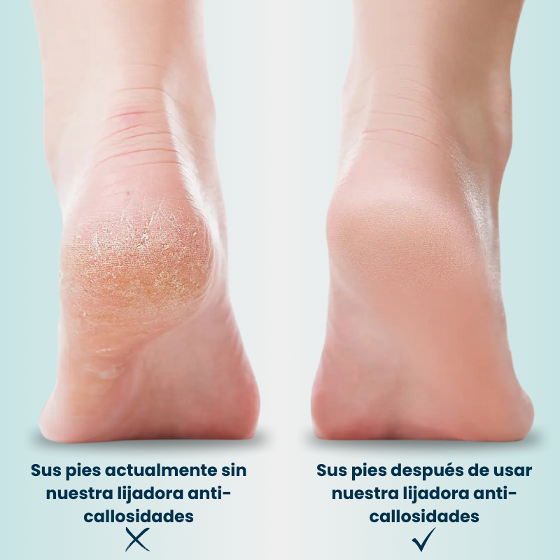 Lijadora anti-callos